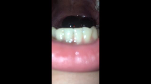 Swallowing marbles смотреть онлайн
