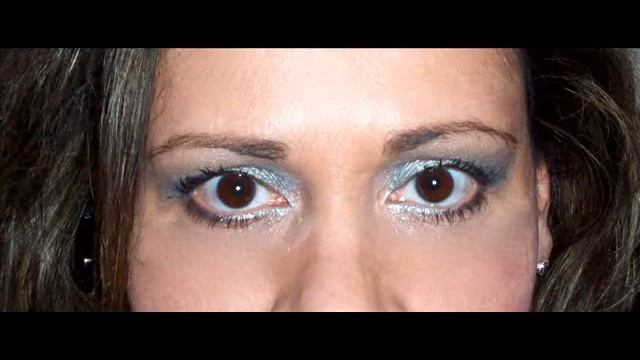 Dark Circles & Under-Eye Puffiness - Gone смотреть онлайн