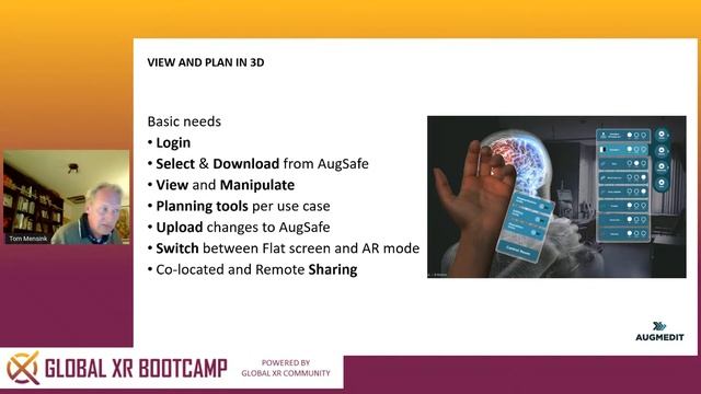 Augmented Reality for Surgery: From Scanner to Operation room, the complete pipeline смотреть онлайн