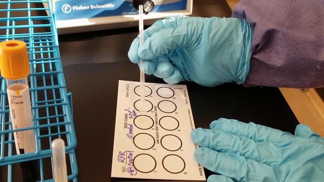 Microbiology:  Rapid Plasma Reagin (RPR) Test