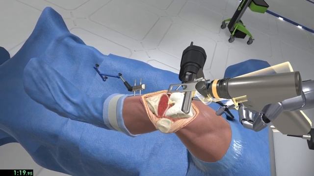[WR] Wraith VR Total Knee Replacement Surgery Simulation [Speedrun] in 2:36 смотреть онлайн
