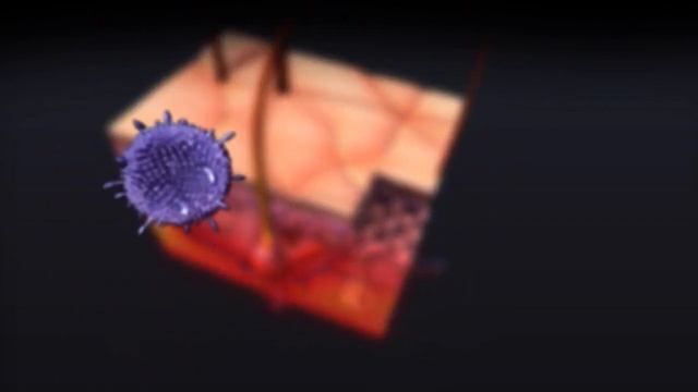 Unveiling Psoriasis: An Animated Dive into the World of Skin’s Silent Struggle смотреть онлайн