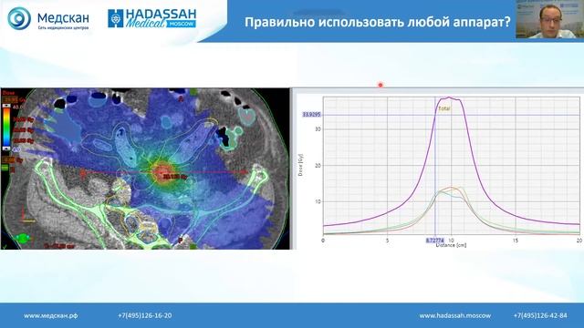 Второй вебинар из цикла "Все, что вы хотели знать о лучевой терапии, но боялись спросить" смотреть онлайн
