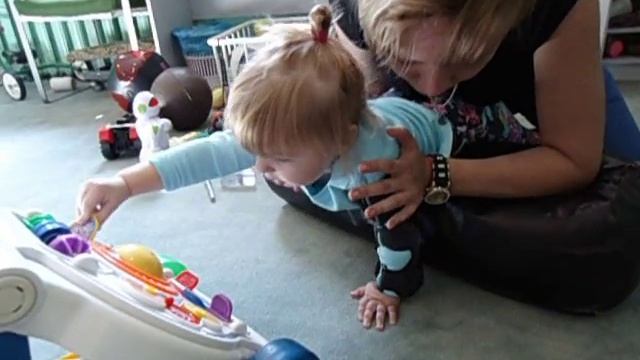 Левосторонний гемипарез ЛФК