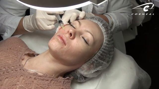 Биоревитализация должна предшествовать контурной пластике смотреть онлайн