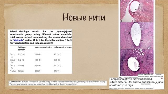 Дигестивные анастомозы смотреть онлайн