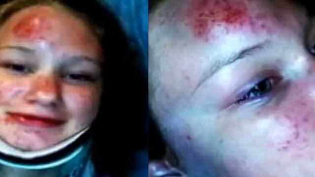 НЕСЧАСТНЫЕ СЛУЧАИ В ИГРЕ Pokemon GO смотреть онлайн