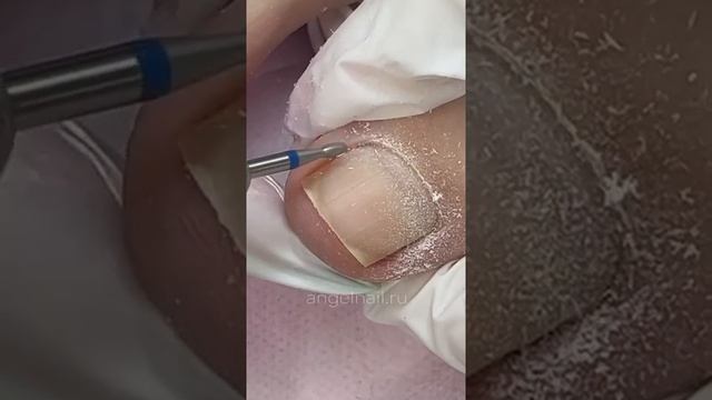 Алмазная фреза «Кристалл» 104.277.524.018 (торнадо) смотреть онлайн