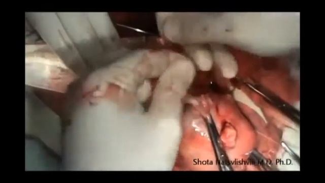 САМЫЙ КОРОТКИЙ ЗЕМНОЙ ПУТЬ ЧЕЛОВЕКА смотреть онлайн