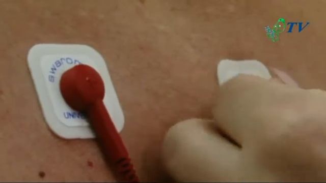 Холтер, СМАД в клинике смотреть онлайн