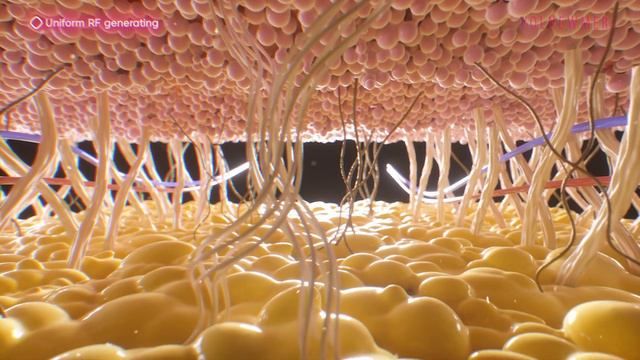 Volnewmer Video Promotion