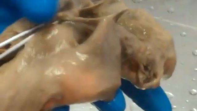 Полость носа и рта. смотреть онлайн