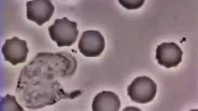 Лейкоцит преследует и поглощает бактерию