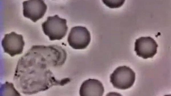 Лейкоцит преследует и поглощает бактерию