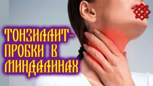 ВСЁ О ТОНЗИЛЛИТЕ. Эффективное Лечение Хронического Тонзиллита.mp4