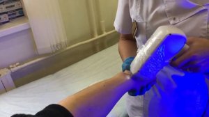 Лазерная Эпиляция проведение процедуры на руке