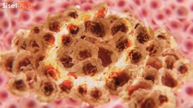 10 ПОВСЕДНЕВНЫХ ВЕЩЕЙ, КОТОРЫЕ МОГУТ ВЫЗВАТЬ РАК смотреть онлайн