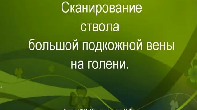 Утолщение стенок ствола большой подкожной вены: есть флебит или нет? смотреть онлайн