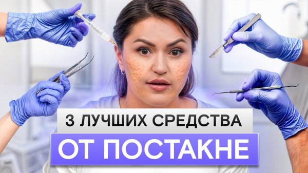 СЛЕДЫ ПОСЛЕ АКНЕ МГНОВЕННО УЙДУТ! / Как убрать шрамы и рубцы на лице?