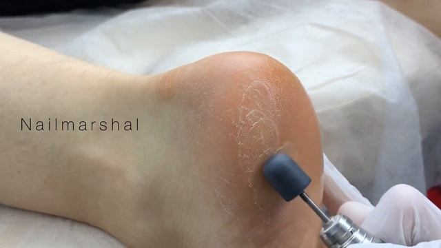 Педикюр колпачками с брендом PinkRoyss #аппаратныйпедикюр #стопы #педикюр #стопа