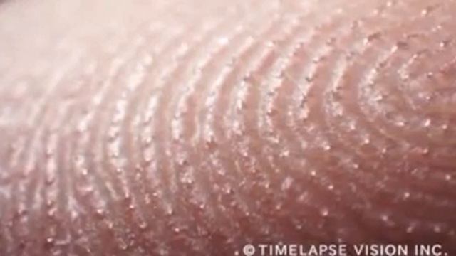Потовые Железы смотреть онлайн