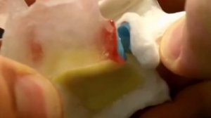 Почему хрустит шея и спина?