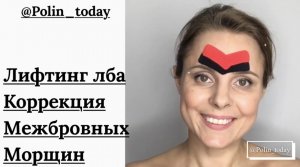 ? Тейпирование лица от межбровных морщин