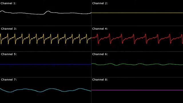 [SNES] Super Mario World: Super Mario Bros. Remix - Oscilloscope View смотреть онлайн