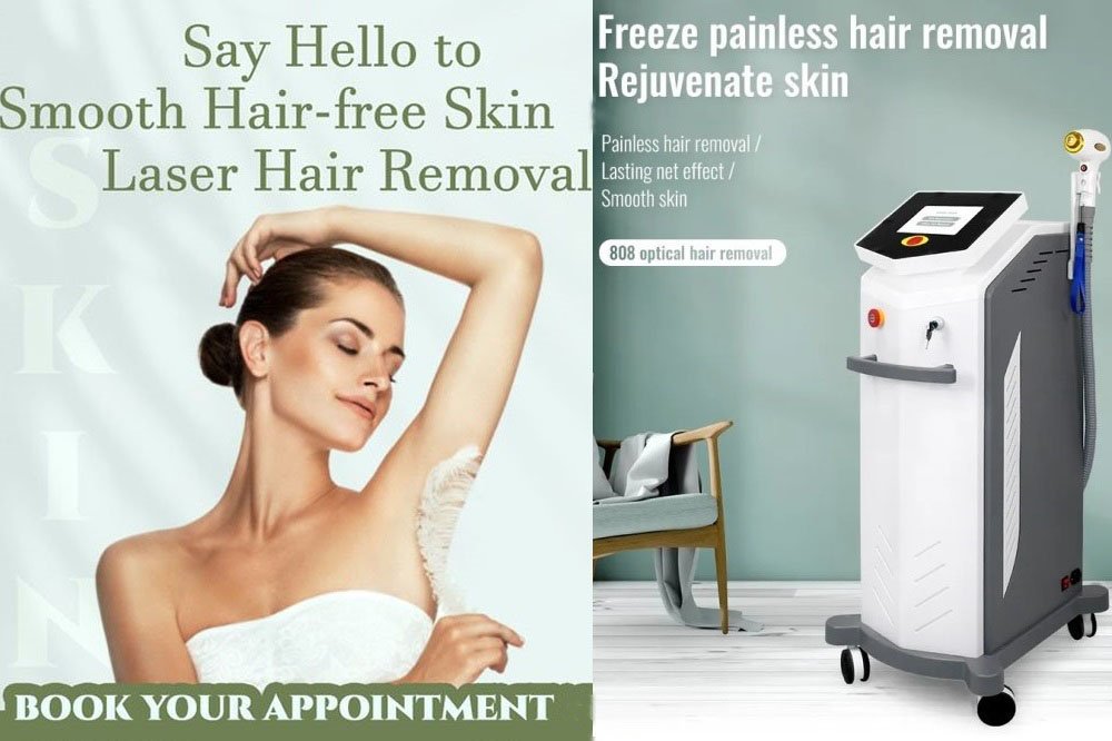 808 diode laser hair removal machine training video-IDEAL BEAUTY #laserhairremoval смотреть онлайн