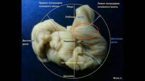 Как прочесть восковую отливку.