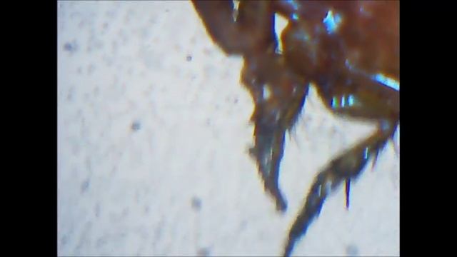 Pulga del gato (ctenocephalides felis) смотреть онлайн