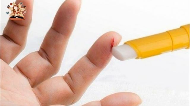 Гигиеническая помада как средство быстрого заживления ран! смотреть онлайн