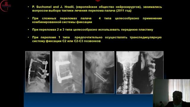 Хирургическое лечение заболеваний и повреждений шейного отдела позвоночника смотреть онлайн
