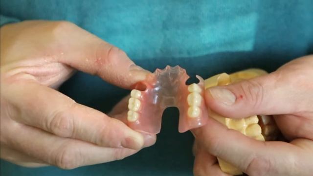 SIMPLEX НЕЙЛОН. СИМПЛЕКС МАТЕРИАЛ/SIMPLEX THERMOPLASTICS/SIMPLEX DENTAL