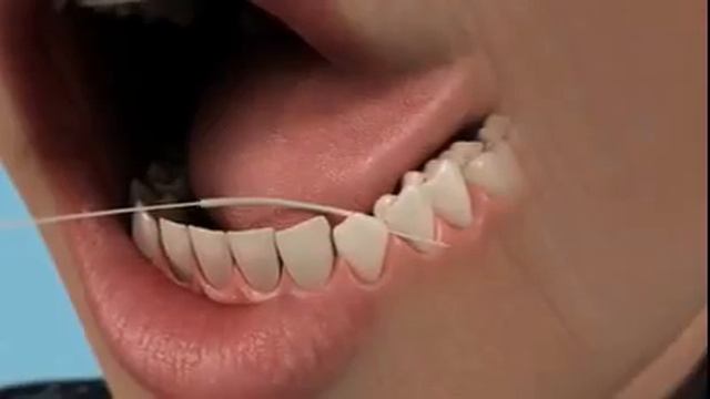 Как чистить зубные протезы смотреть онлайн