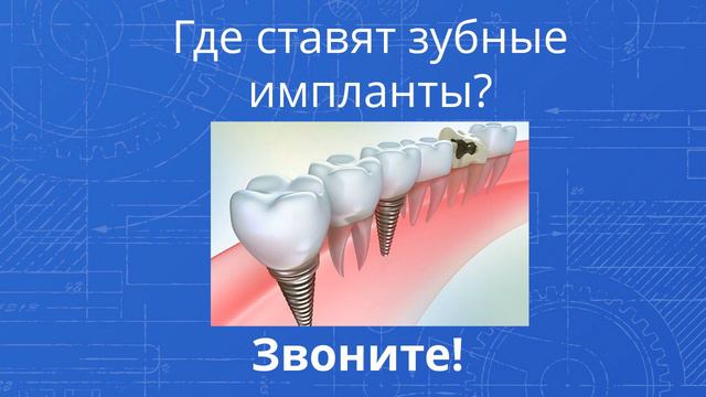 Зубные импланты Оренбург - Звоните! 560-560 смотреть онлайн