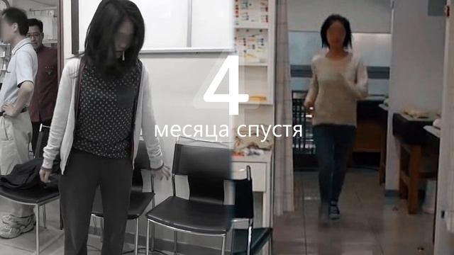 Спастическая кривошея и обобщенная дистония. Лечение до и после смотреть онлайн