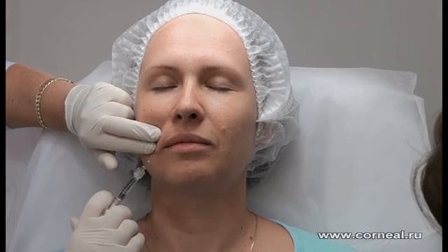 Канюля - уверенно, но не быстро смотреть онлайн