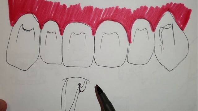 Часть 5. А вы знаете как сохранить свои передние зубы? смотреть онлайн