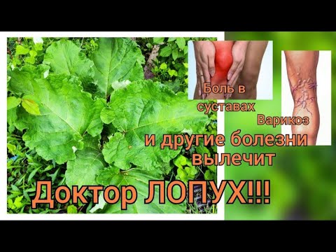 Компресс из лопуха. Что делать, если болят колени.