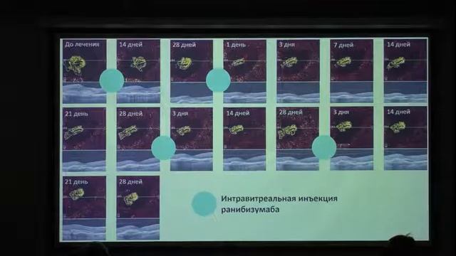 За кулисами анти-VEGF-терапии Докладчик Шаимов Т.Б. смотреть онлайн