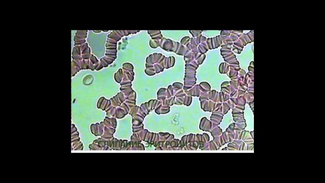 #Hudr8 о продукте компании Bestbepic смотреть онлайн