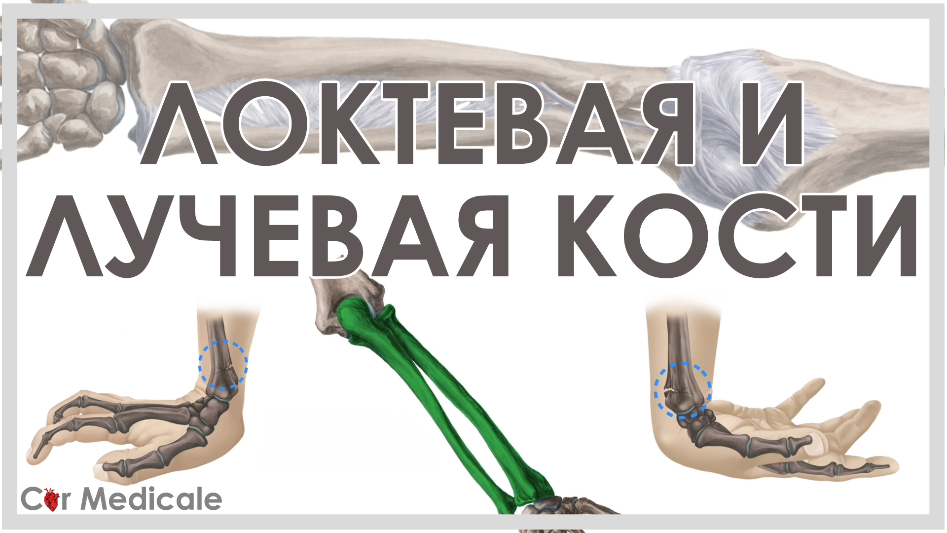 Локтевая и лучевая кости смотреть онлайн