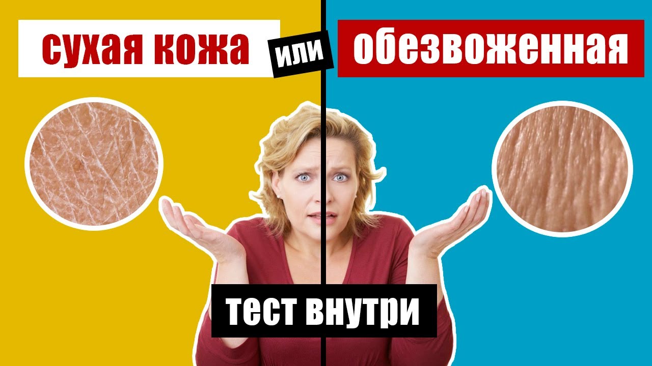 Сухая кожа - причины и правильный физиологический уход за кожей