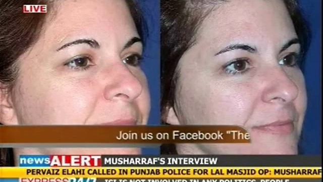 Whitening creams highly unsafe for skin: Dr Osman Tahir смотреть онлайн