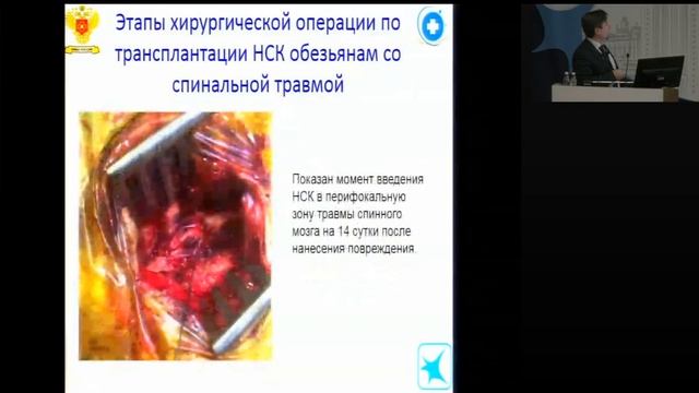 Тканеинженерные контрукты для терапии спинальной травмы, исследование на приматах Баклаушев Владими смотреть онлайн
