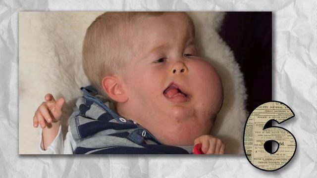 10 САМЫХ СТРАШНЫХ МУТАЦИЙ смотреть онлайн