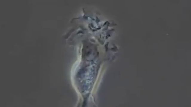 Дендритные клетки осуществляют фагоцитоз (поглощение сторонних частиц). смотреть онлайн