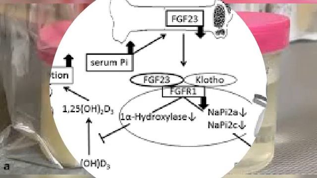 PHOSPHATURIA LEARN ABOUT #PHLF смотреть онлайн