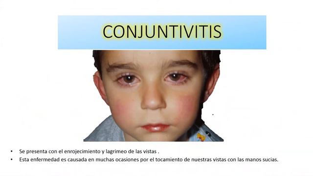 Enfermedades más comunes смотреть онлайн